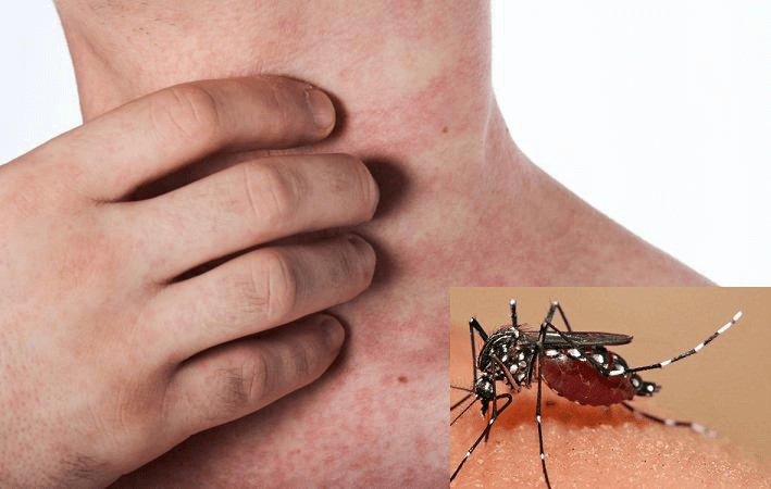 Phát hiện đột phá giúp tìm ra phương pháp chữa bệnh sốt rét