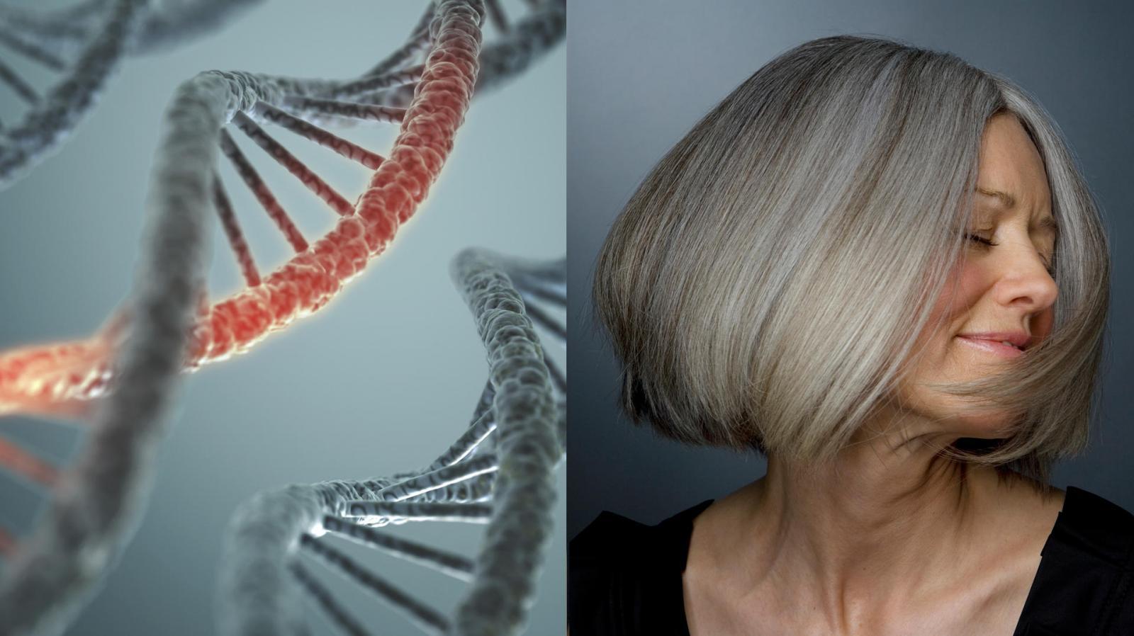 Đâu là giải pháp tối ưu cho người tóc bạc sớm do di truyền?