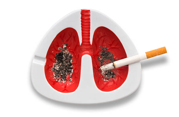 Khói thuốc lá gây bệnh ung thư phổi