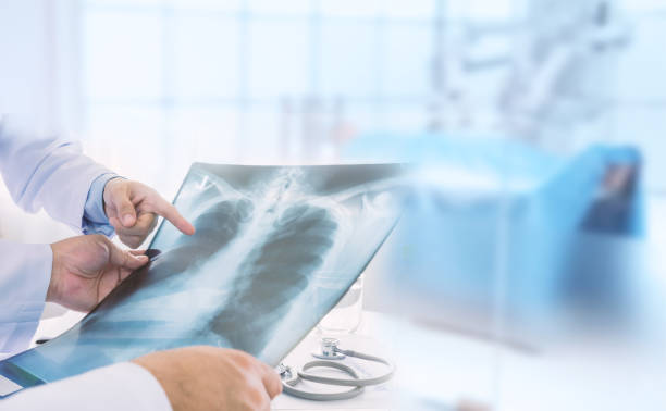 Suy hô hấp có thể do các bệnh lý ở phổi gây ra