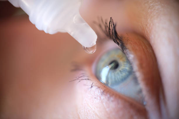 Một số bệnh nhân cần dùng thuốc nhỏ mắt để giảm sưng