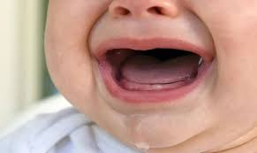 Trẻ mọc răng thường chảy nước miếng.