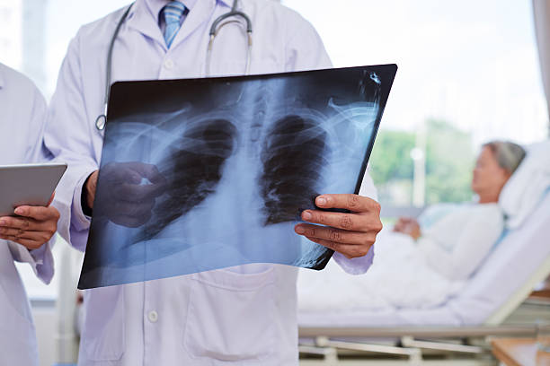 Chụp X - quang tim phổi là chẩn đoán hình ảnh bắt buộc khi khám tổng quát