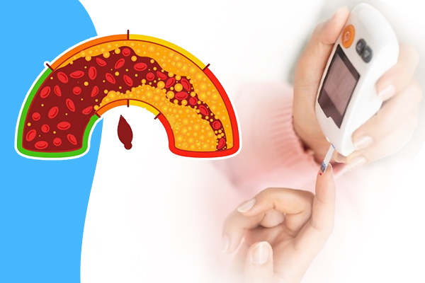 Cách giảm mỡ máu cho người tiểu đường hiệu quả, an toàn