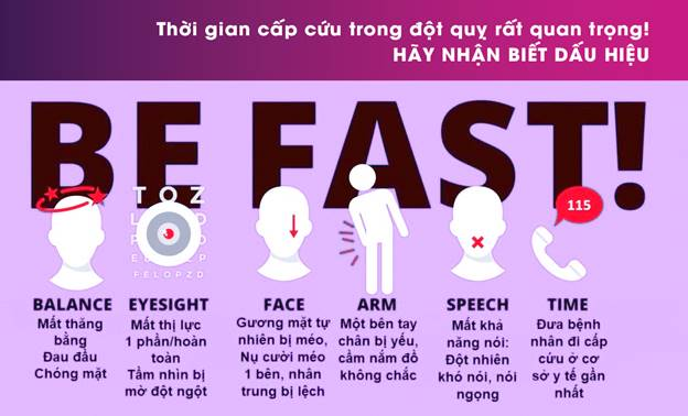 Quy tắc “BE FAST” cảnh báo đột quỵ.