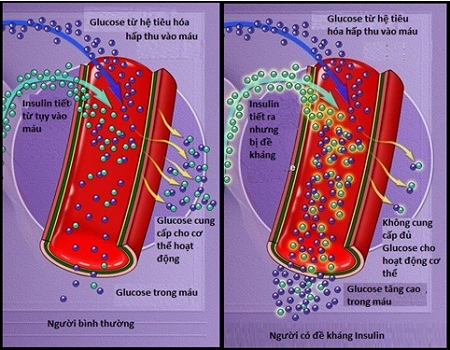 Thức khuya làm tăng tình trạng kháng insulin.