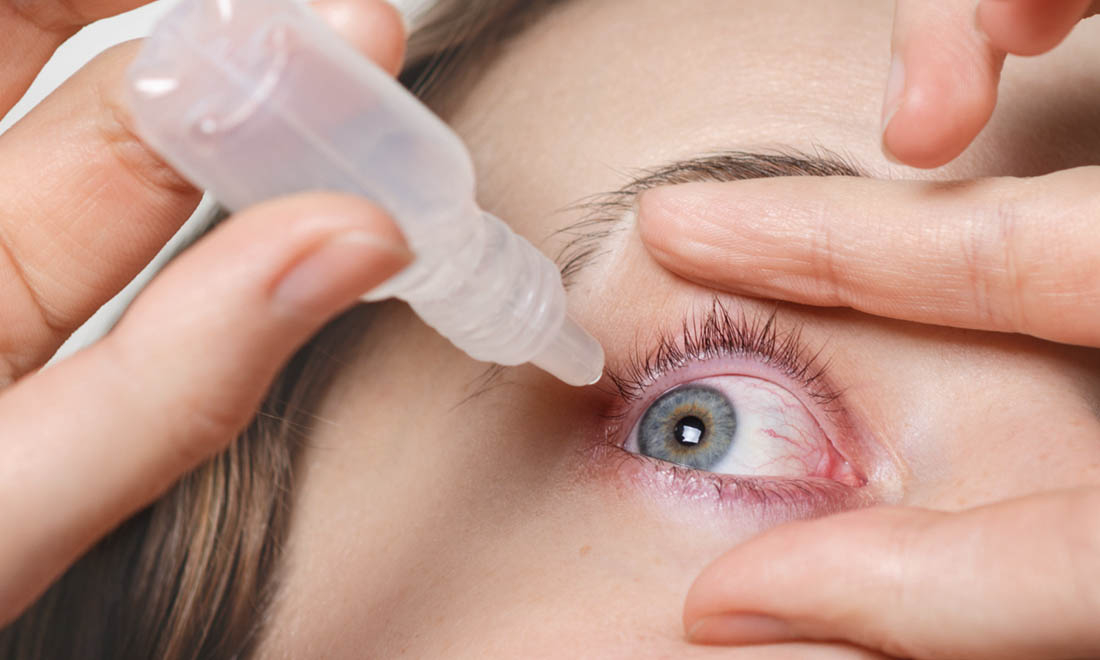  Sử dụng thêm nước mắt nhân tạo để cung cấp độ ẩm và bôi trơn cho mắt.
