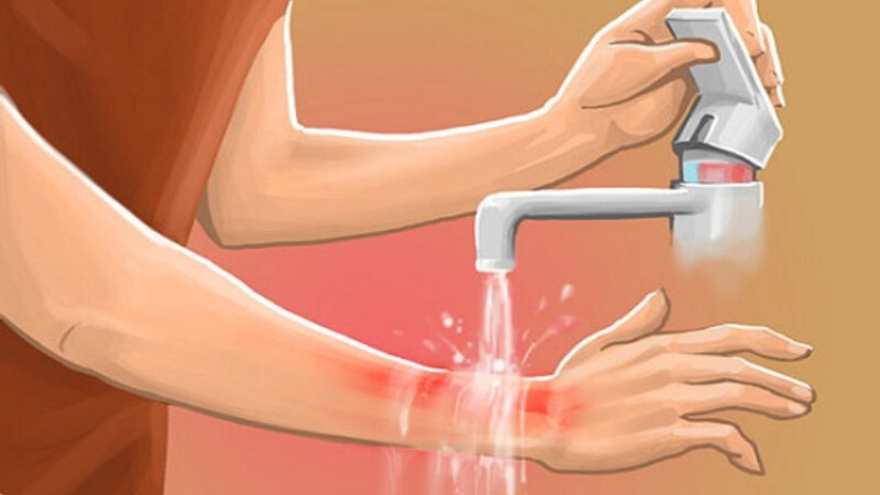 Xối rửa vết thương dưới vòi nước chảy mạnh 15 phút.