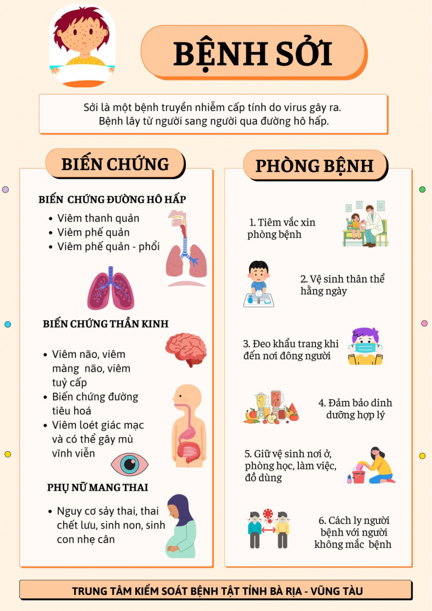 Một số lưu ý về bệnh sởi cần chú ý.