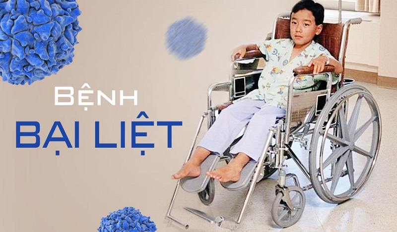 Nguy cơ bại liệt: Cha mẹ cần làm gì để bảo vệ con?