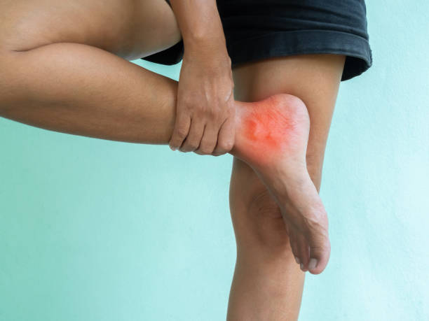 Ăn nhiều thịt đỏ làm tăng nguy cơ mắc bệnh gút.