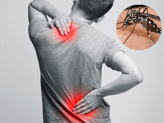 Bệnh Chikungunya gây đau khớp kéo dài.