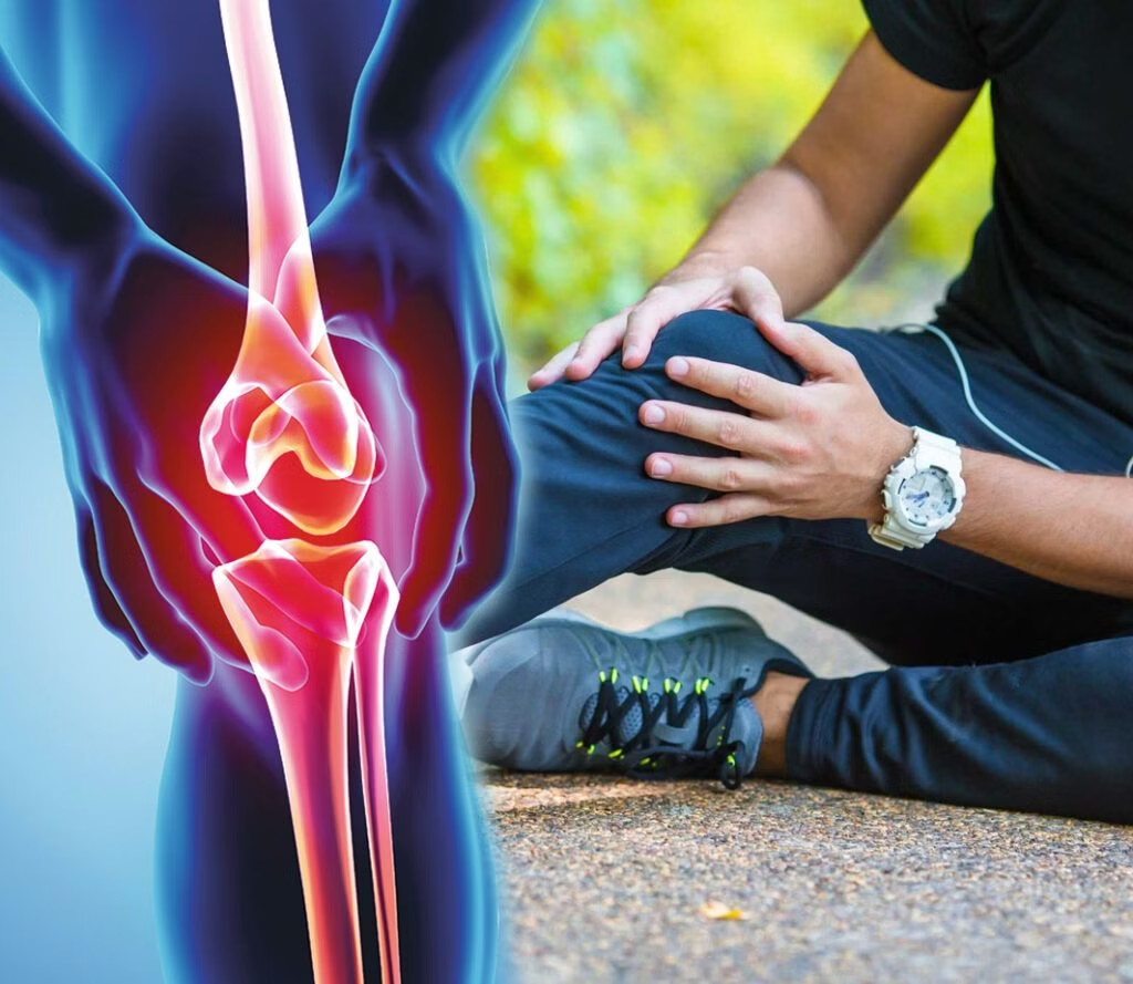 Tràn dịch khớp gối ở người bệnh gout: Biến chứng dễ gặp thường bị chủ quan