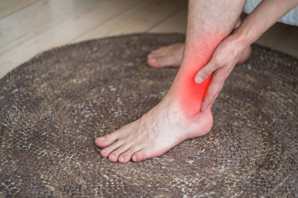 Biến Chứng Viêm Gân Bàn Chân Ở Người Bệnh Tiểu Đường